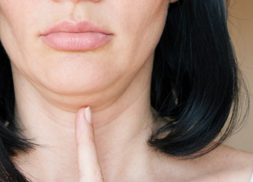Woman pointing at her double chin