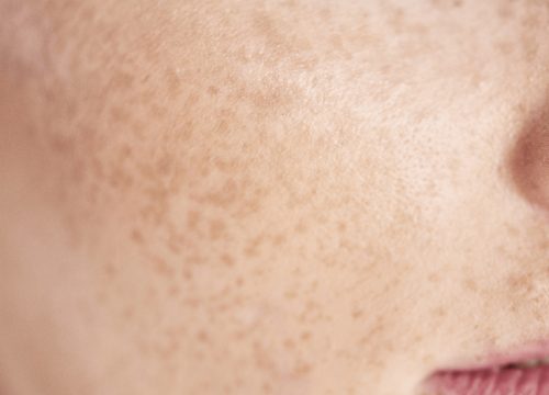 Closeup on a woman's freckles