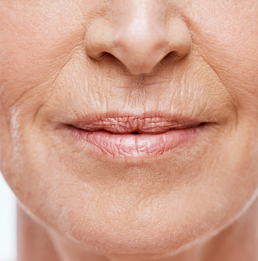 Close-up photo of wrinkles around a woman's mouth