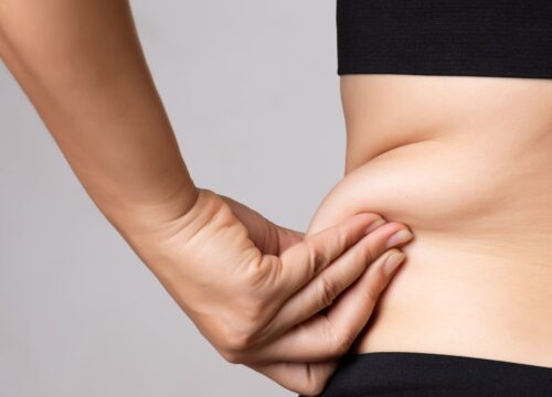 Photo of a woman tugging on the stubborn fat on her side