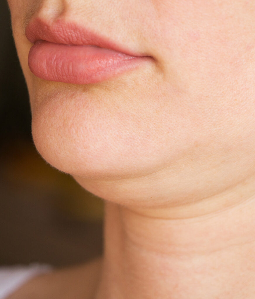 Photo of a woman's double chin